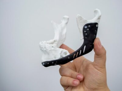 3D printed jaw